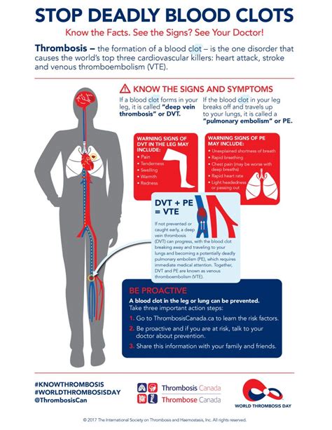 Stop Deadly Blood Clots Poster And Infographic Thrombosis Canada