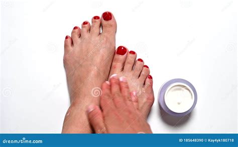 The Girl Is Rubbing Cream On Her Feet With Problem Areas Of The Skin On White Background Stock