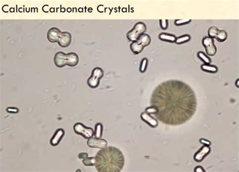 Differences in the free ca2+ in undiluted urine from stone formers and normal. Urine crystals - Veterinary Technician 220 with Kristin ...