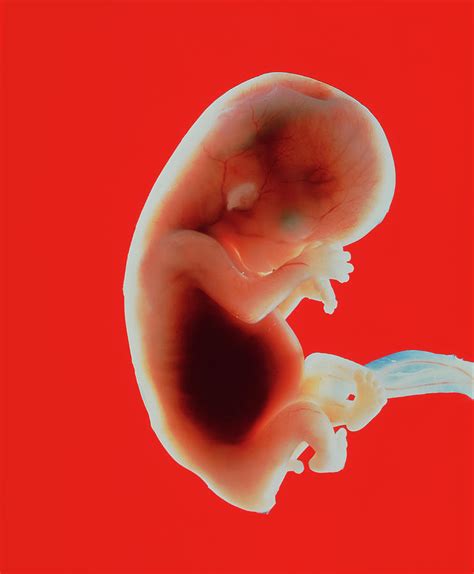 Foetus At 11 Weeks Photograph By Garry Watsonscience Photo Library