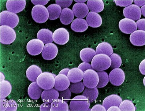 Staphylococcus Aureus Agentes Biológicos Bacteria
