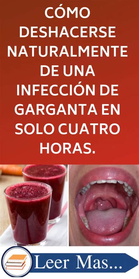 Cómo Deshacerse Naturalmente De Una Infección De Garganta En Solo