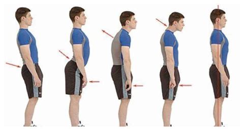 Why Posture Correctors Wont Fix Your Posture Posturepro