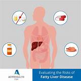 Liver Disease Doctor Near Me Pictures