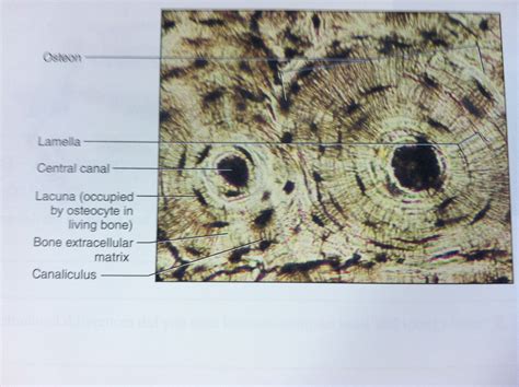 Check spelling or type a new query. Osteon slide tissue histology | Anatomy and physiology, Tissue, Physiology