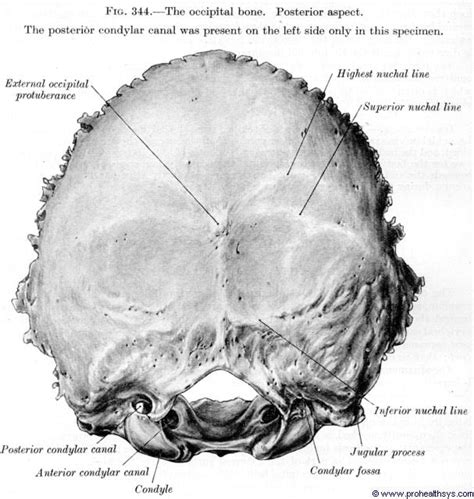 Occipital Bone Anatomy Sigmoid Axial