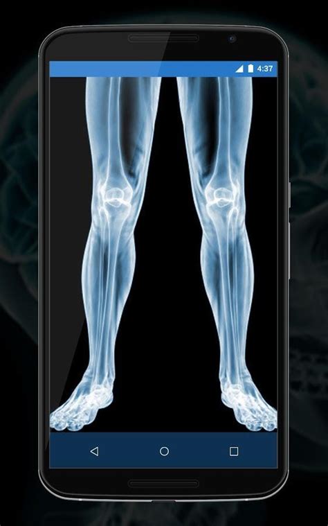 We did not find results for: Real X Ray Body Scanner Prank: X Ray App for Android - APK ...