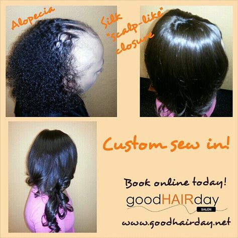 In patients who frequently wear their hair too tight in ponytails, buns, hair extensions, weaves, cornrows, dreadlocks, or braids. Custom Sew - In Weave, Alopecia Hair Loss, Protective ...