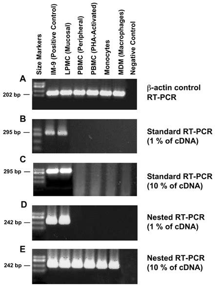 トップ 100+ Rt Pcr - 浅川
