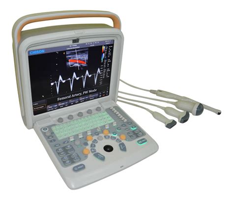 Color Doppler Ultrasound Scanner And Two Probes Convexandlinear Probe