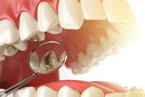 Local Denture Repair - Same Day Dentures near Me (24/7) Low prices across earth's biggest selection of books, music, dvds, electronics, computers, software, apparel & accessories, shoes, jewelry, tools & hardware, housewares, furniture, sporting goods, beauty & personal care, groceries & just about.