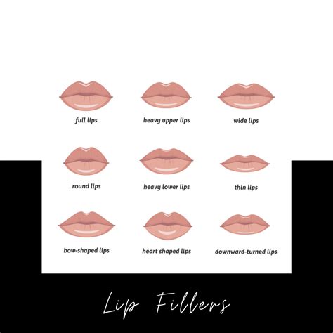 Lip Fillers Before And After Faqs And Cost
