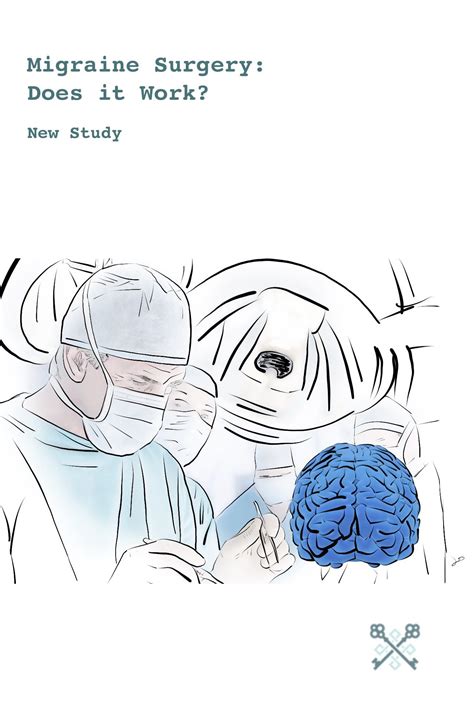 Does Migraine Surgery Work New Study New Article Migraine Relief