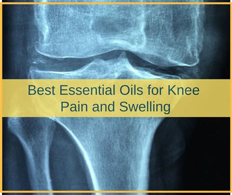Essential Oils For Knee Pain And Swelling Effective Ways To Use Them