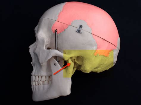 Pain Behind Ears And Down The Neck When Turning Head Left Or Right Side