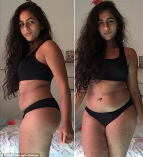 Women Share Photos Of Cellulite On Instagram For New Body Positive
