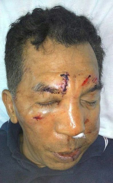 Koperasi serbaguna kampung tasek chempedak berhad. Koperal Polis Dibelasah Pekerja Asing Di Pulau Pinang ...