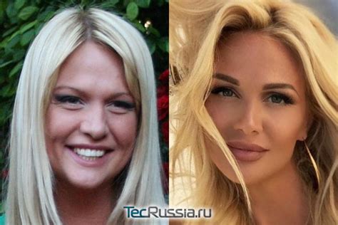 Виктория Лопырева до и после пластики фото и все операции бывшей девушки Николая Баскова
