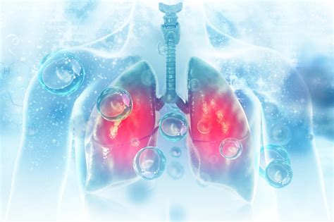 Little is known about the impact of viral infections on lung matrix despite its important contribution to mechanical stability and structural support. Antibiotics can leave the lungs susceptible to flu virus ...