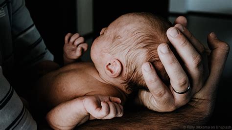 Neugeborenen Akne Muss Ich Mir Sorgen Machen Babyakne