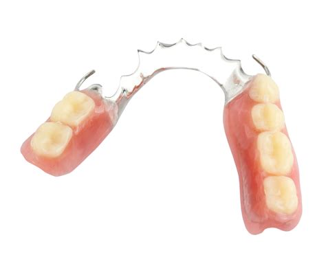 How Do Partial Dentures Stay In Dr Steven C Hewett Dds