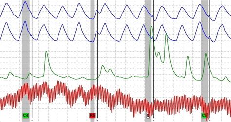 Lie detector tests (polygraphs) are not permissible evidence in law because it's possible for a guilty person to pass and for an innocent person to fail. Maryland Lie Detector Tests | Polygraph Tests in Maryland
