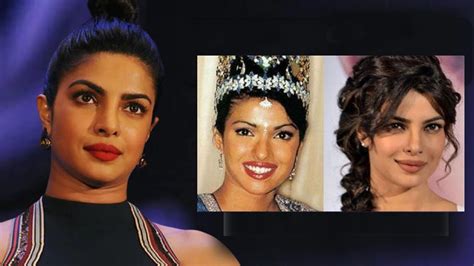 Priyanka Chopra Reveals That Her Nose Surgery Went Wrong She Was