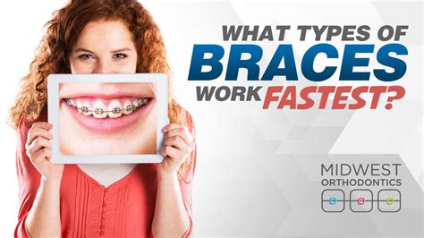 What Type Of Braces Work The Fastest Midwest Orthodontics Center Blog