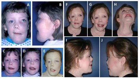 Clinical Guidelines For The Management Of Craniofacial