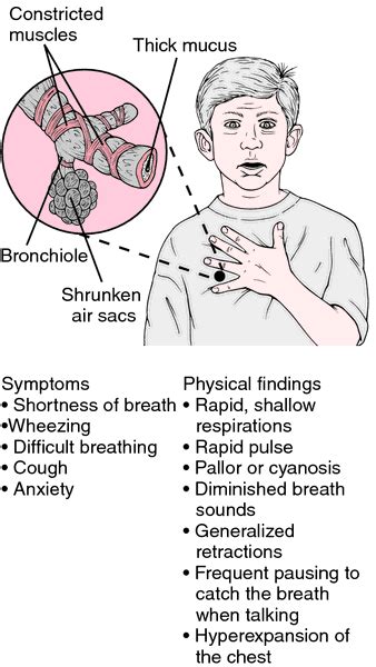What are the signs that you might have asthma? Atopic asthma | definition of atopic asthma by Medical ...