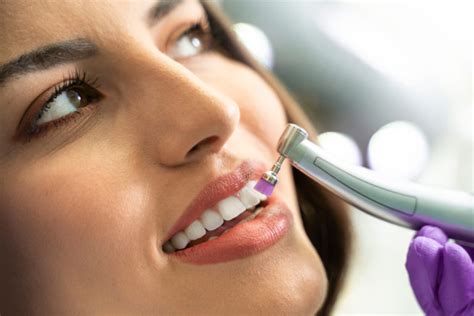 Teeth Polishing In Singapore What Where And How Much