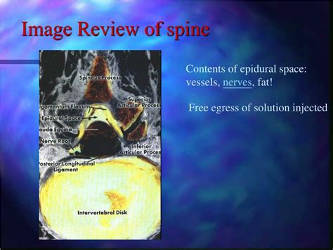 Ppt Image Review Of Spine Powerpoint Presentation Free Download Id