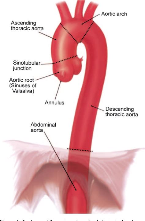 Figure 1 From Thoracic And Abdominal Aortic Aneurysms Semantic Scholar