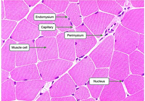 Skeletal Muscle Histology Labeled