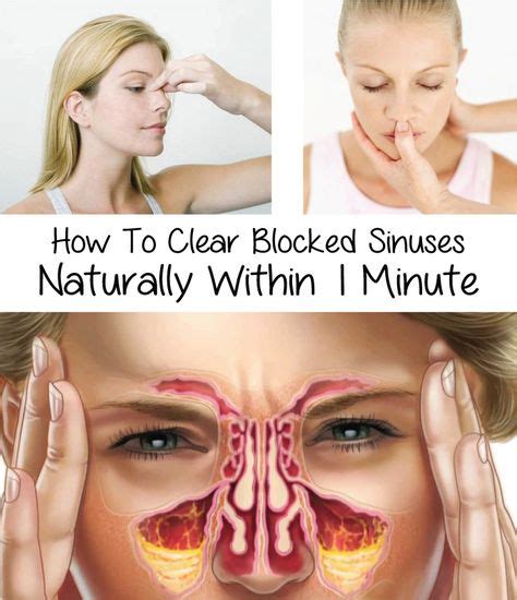 How To Clear Blocked Sinuses Naturally Within 1 Minute Sinus