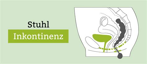 Sie betrifft menschen aller altersgruppen, kommt aber häufiger bei älteren menschen vor. Stuhlinkontinenz » Darminkontinenz: Symptome, Ursachen ...