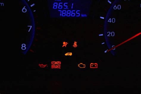 Check Engine Light 2025 Hyundai Elantrapodcast Personal