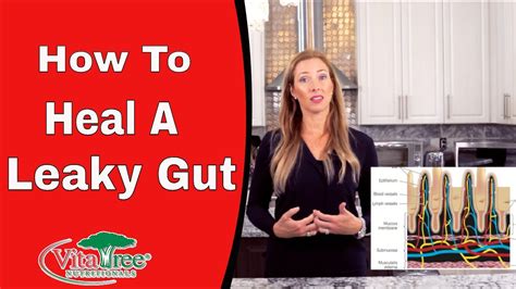 How To Heal Leaky Gut Syndrome Naturally Vitalife Show Ep 290 Youtube