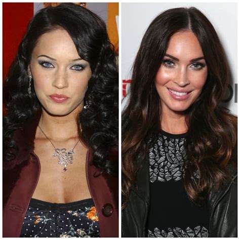 Amazing Plastic Surgery Before An Dafter Celebrity