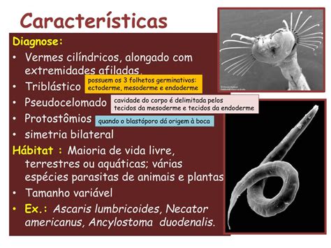 é Característica Da Maioria Dos Asquelmintos De Vida Livre