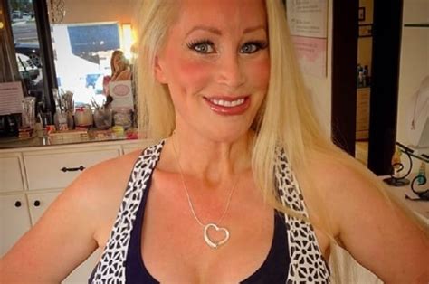 Plastic Surgery Addicted Texas Woman Comes To Terms With Looks After Diagnosed With Medical