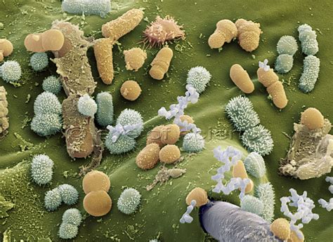 Bacteria And Fungus Seen In The Scanning And Transmission Electron