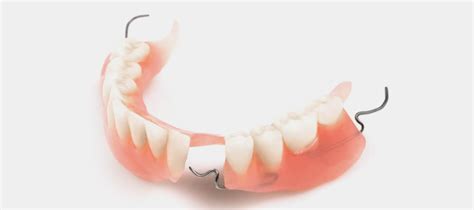 Removable Partial Dentures Ensure Dental Care