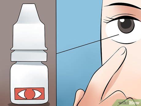 How not to treat a hangnail. How to Make Your Eyes Stop Hurting after Swimming: 15 Steps