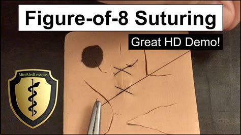 Suture Tutorial Figure Of 8 Technique Step By Step Hd Instructions
