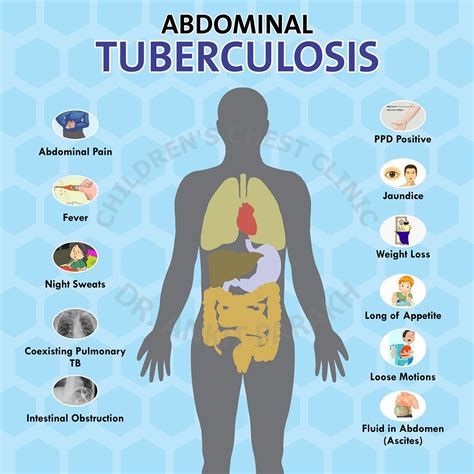 Abdominal Tuberculosis Dr Ankit Parakh