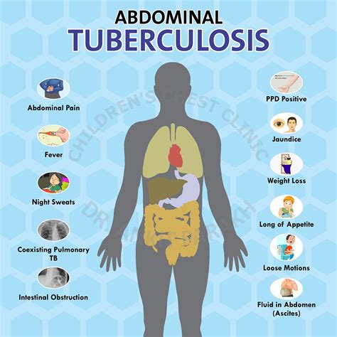 In most forms of the disease, the bacillus spreads slowly and widely in the lungs, causing the formation of hard nodules. Abdominal Tuberculosis - Dr. Ankit Parakh