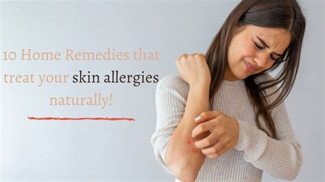 10 Home Remedies That Treat Your Skin Allergies Naturally Flaming Truth