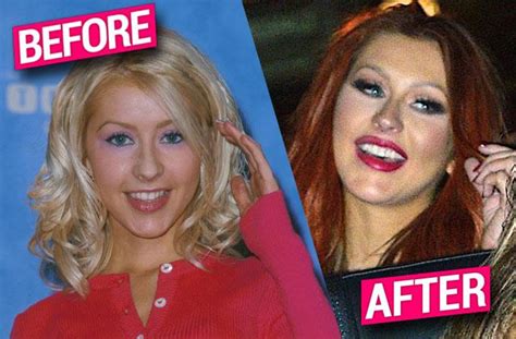 Fillers Implants And More Christinas Face Is More Plastic Than Ever