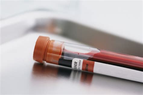 Blood Sample Tests In Dui Cases — Massachusetts Criminal Defense